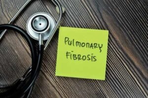 pulmonary fibrosis