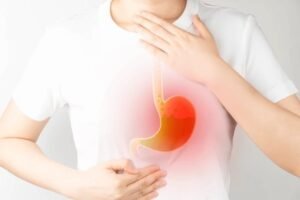 relief for acid reflux cough