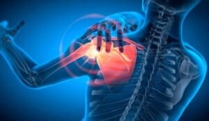 shoulder pain