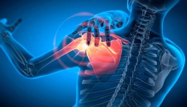 shoulder pain