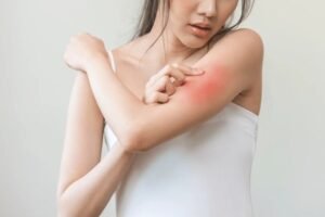 skin infections