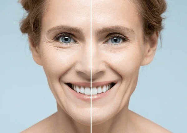 skin tightening