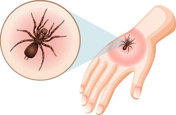 spider bites