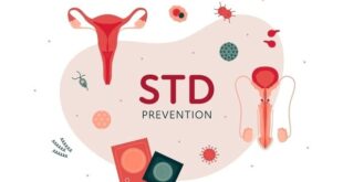 std