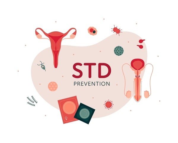 std