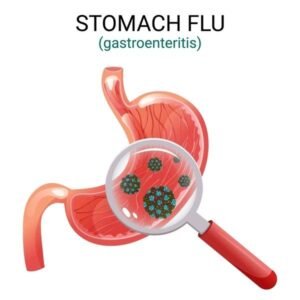 stomach flu