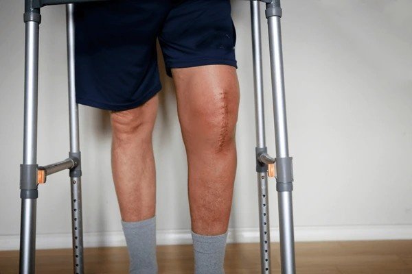 swelling after surgery