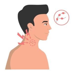swollen lymph nodes