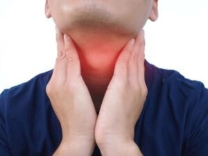 tonsillitis