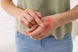 wounds