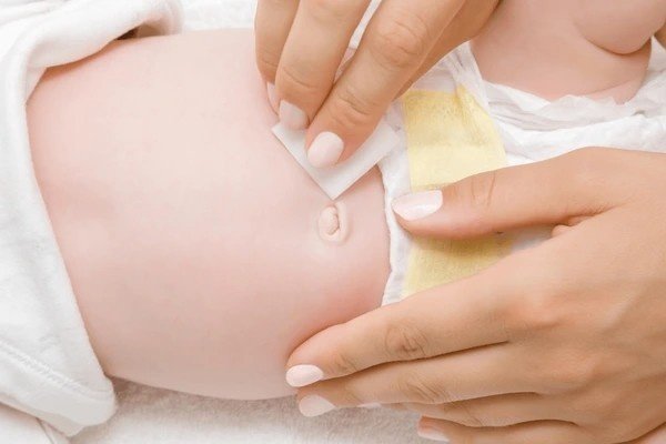 yeast infection in belly button
