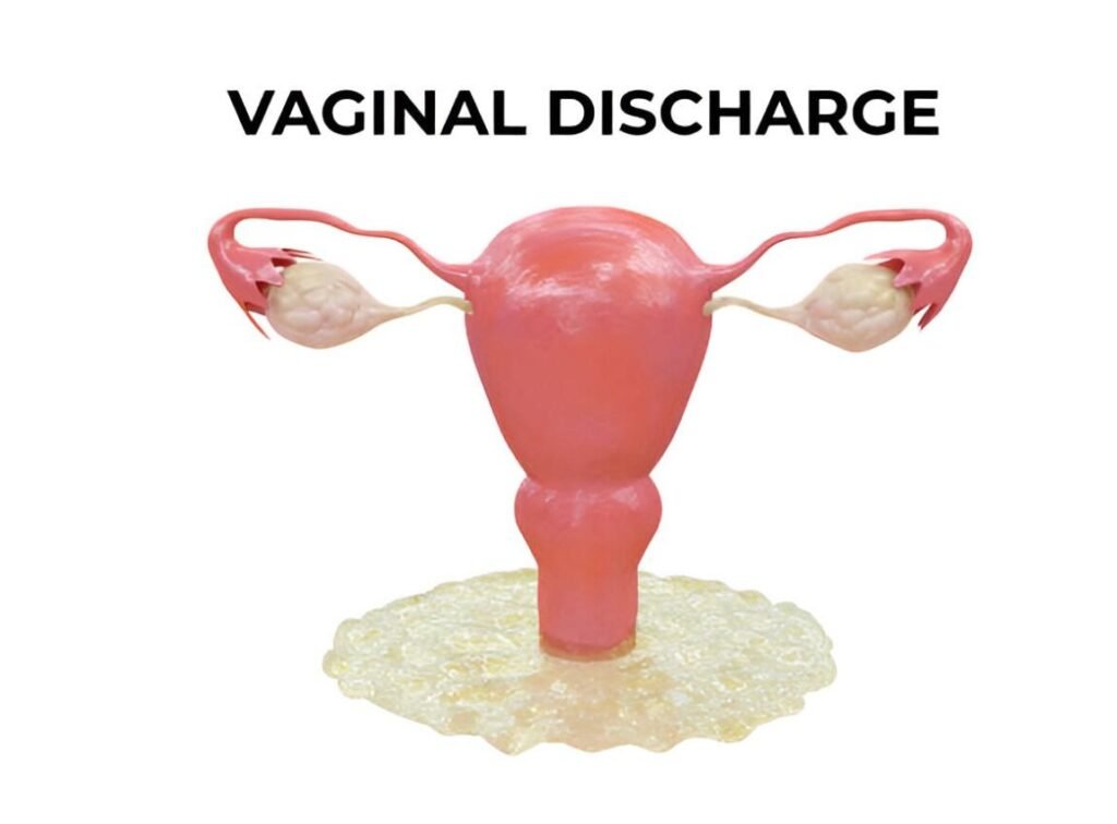 watery discharge