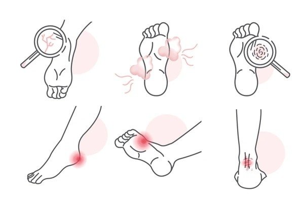 wound